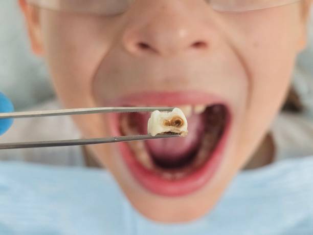 Best Teeth Whitening  in Richland, WA