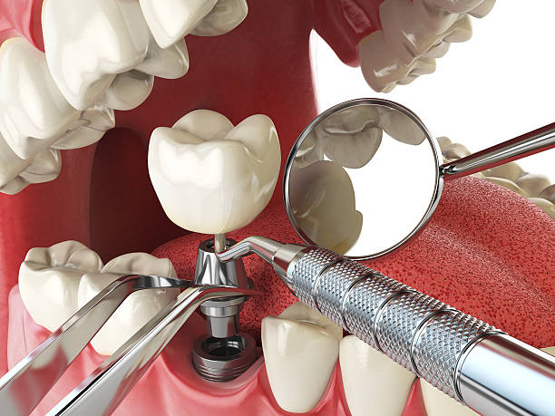 Best Tooth Pain Emergency Relief  in Richland, WA